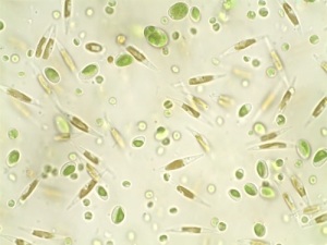 Phytoplankton may be tiny but they are the base for much of what we see and use in the ocean!